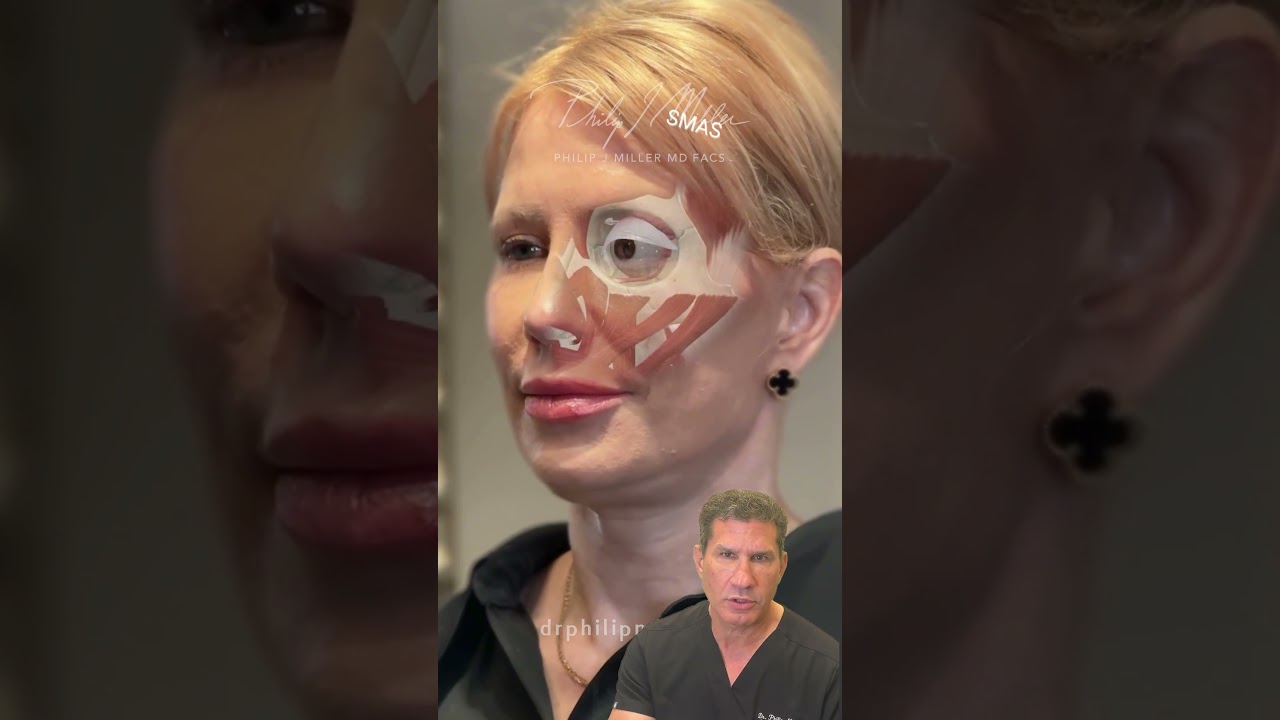 Hot Take: Deep Plane Facelift Isn’t for Everyone — Here’s What I Do Instead
