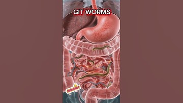 3D Realistic Animation of Human Digestive System Infected with Worms | Educational Medical Video