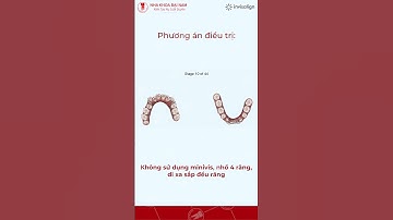 Niềng răng Invisalign có hiệu quả không | #shorts