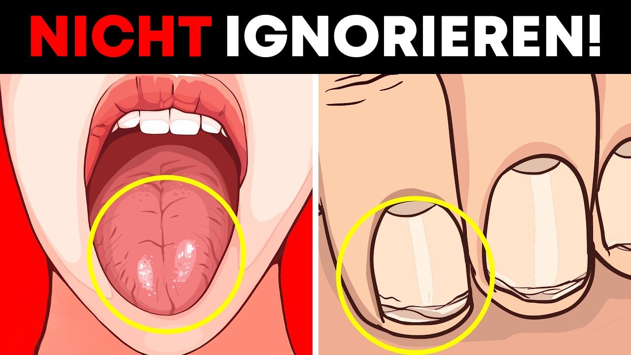 Diese Anzeichen darfst du auf keinen Fall ignorieren! YouTube