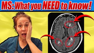 7 Things you NEED To Know About Multiple Sclerosis (MS) in 2026