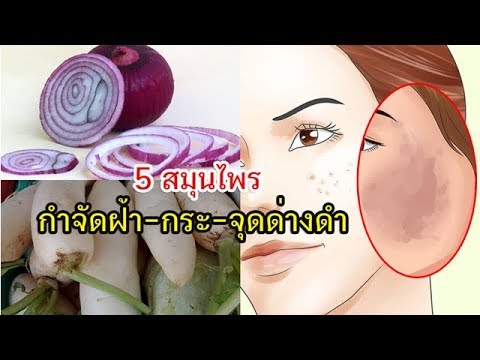 5 สมุนไพร 'กำจัดฝ้า กระ จุดด่างดำ' แก้หน้าพัง ให้สวยใส ฉบับประหยัด[เคล็ดลับสุขภาพ]