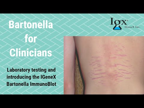 Video: Infeksioni Bartonella Tek Qentë