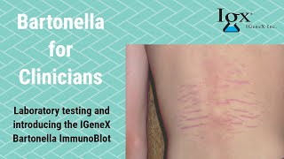 Introducing IGeneX Bartonella ImmunoBlots