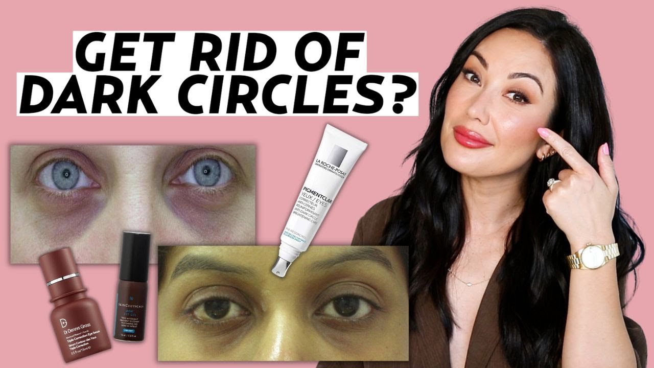 expert-tips-to-get-rid-of-dark-circles-skincare-treatment