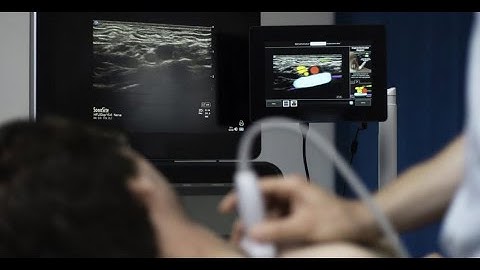 ScanNav Anatomy Peripheral Nerve Block (PNB)