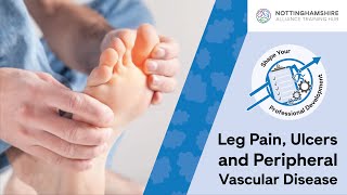 Leg Pain, Ulcers and Peripheral Vascular Disease - CPD