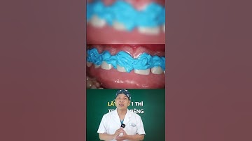 Lấy Dấu Răng Có Cảm Sẽ Như Thế Nào? | Nha Khoa Minh Châu