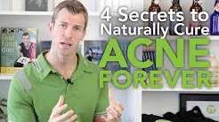 4 Secrets to Get Rid of Acne Naturally