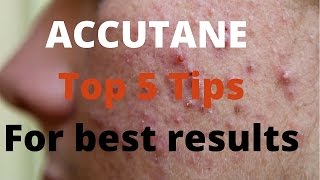 Accutane 5 tips by Dermatologists