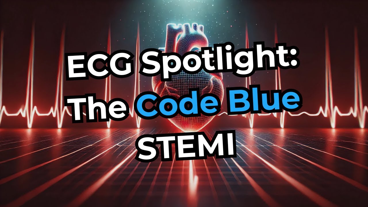 Interesting ECGs: The Code Blue STEMI