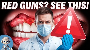 Bleeding Gums: Why Are Your Gums Bleeding While Brushing?