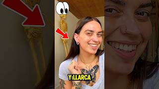 Bir Hata Yüzünden Kulak Memesi Koptu Sonra Yaptiği Şey Şok