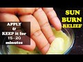 2 DIY FACE MASK FOR SUNBURN RELIEF | HOME REMEDIES FOR SUNBURN ON FACE