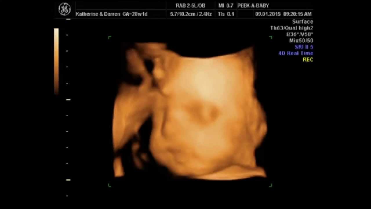 4D Ultrasound Baby Boy Scan Charlie (28 Weeks) YouTube