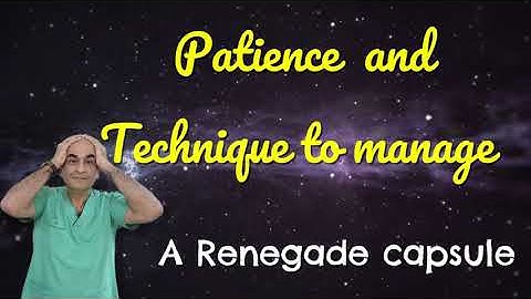 Interesting steps for managing a naughty & obstinate capsule-  Dr Kamal B Kapur