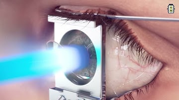 Medical Animation | Showreel | 2023 | Studio Image Works