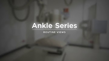 Ankle Series AP, Oblique, and Lateral Views - Radiography Positioning