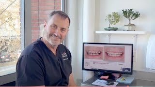 Dental Composite Bonding Auckland - Dr Matt Sumner - Accent Your Dentists - The Smile Restore