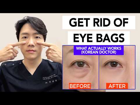 How to Get Rid of Eye Bags at Home — What Actually Works