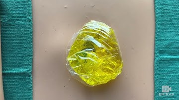 Hernia Reduction Techniques