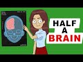 My Life With Half A Brain