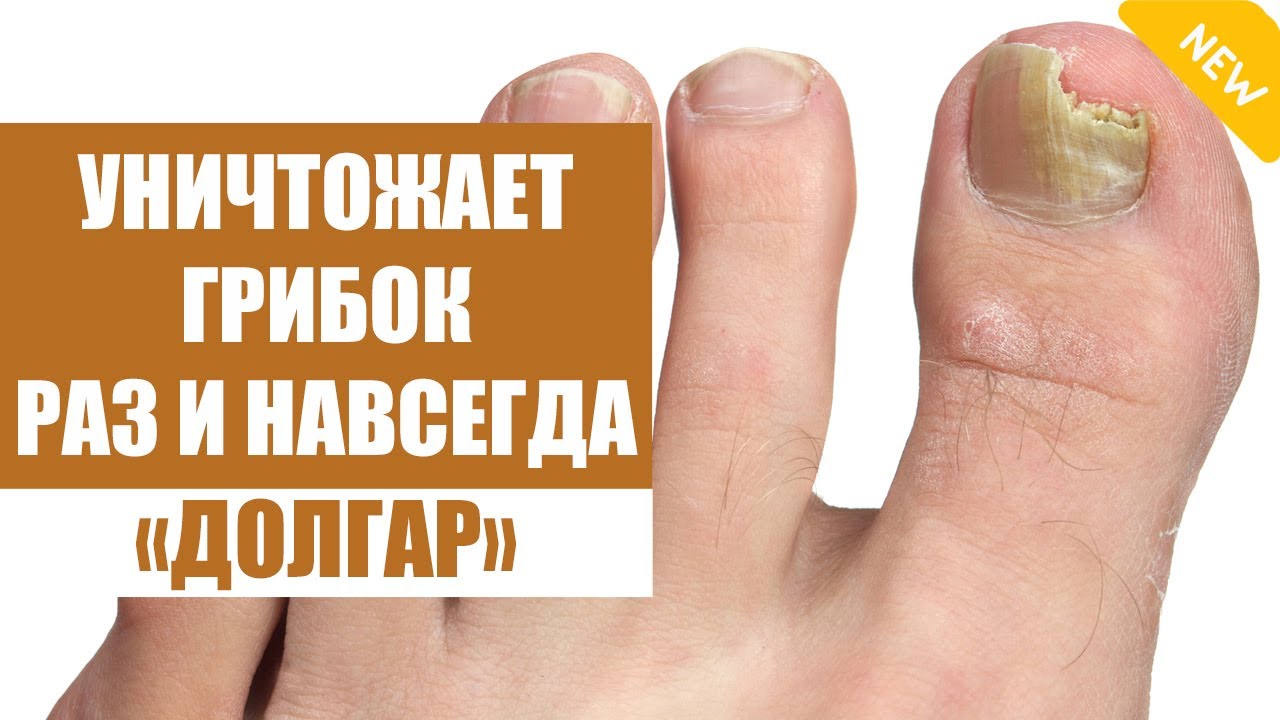 От грибка на ногах лекарство таблетки