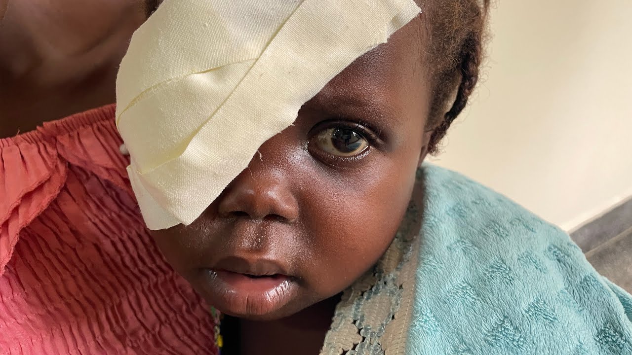 Baby Mercy&rsquo;s eye operation/surgery was successful
