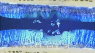 B 001 Arthrose - SD PAL/ B 001 Arthrosis - SD PAL