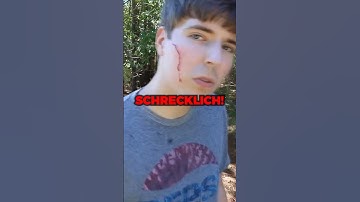 MrBeast erstes Video!