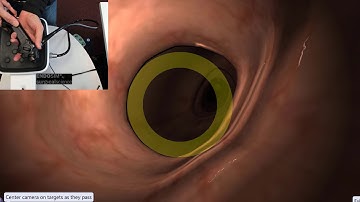 EndoSim Fundamental Endoscopy Skills 1: Knob Handling with Hand Coordination