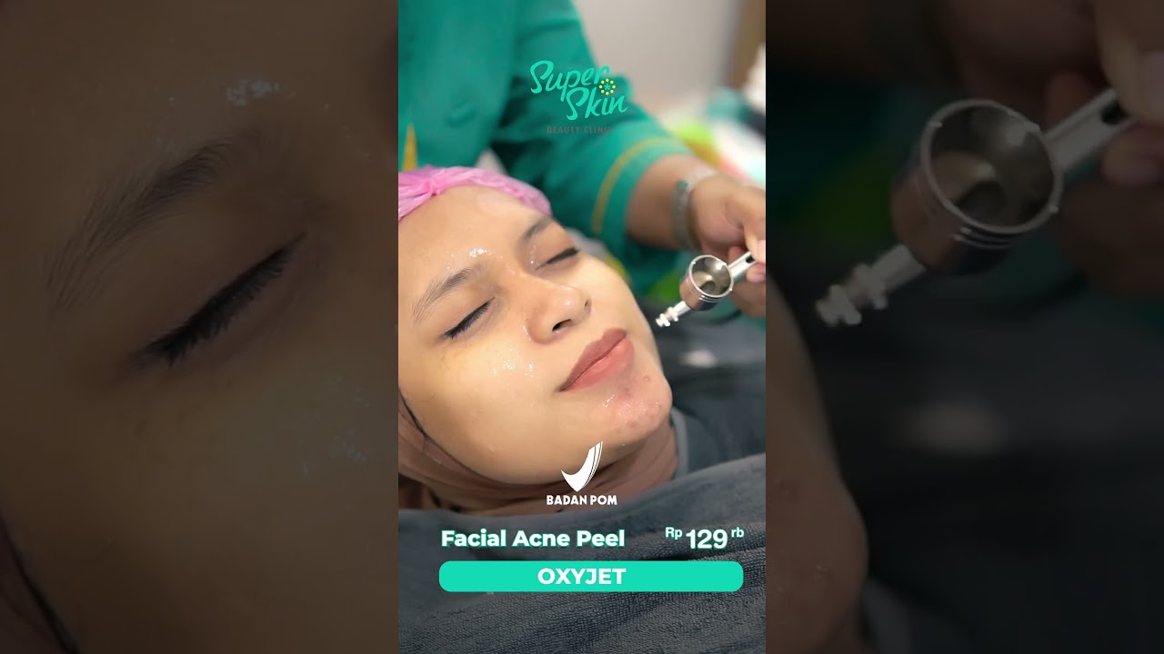 Yuk facial di SuperSkin!  