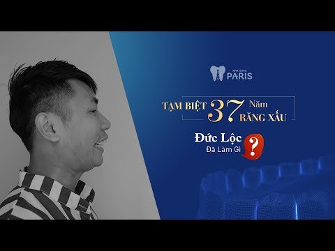 Video Tạm biệt 37 năm răng xấu - Chuyên gia trang điểm Đức... - youtube