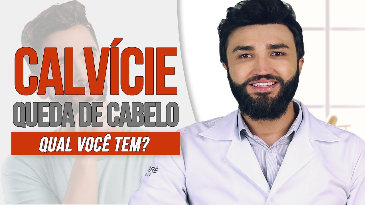 QUEDA DE CABELO ou ALOPÉCIA: Qual a diferença? Você tem qual ? | Calvície | Dr Lucas Fustinoni