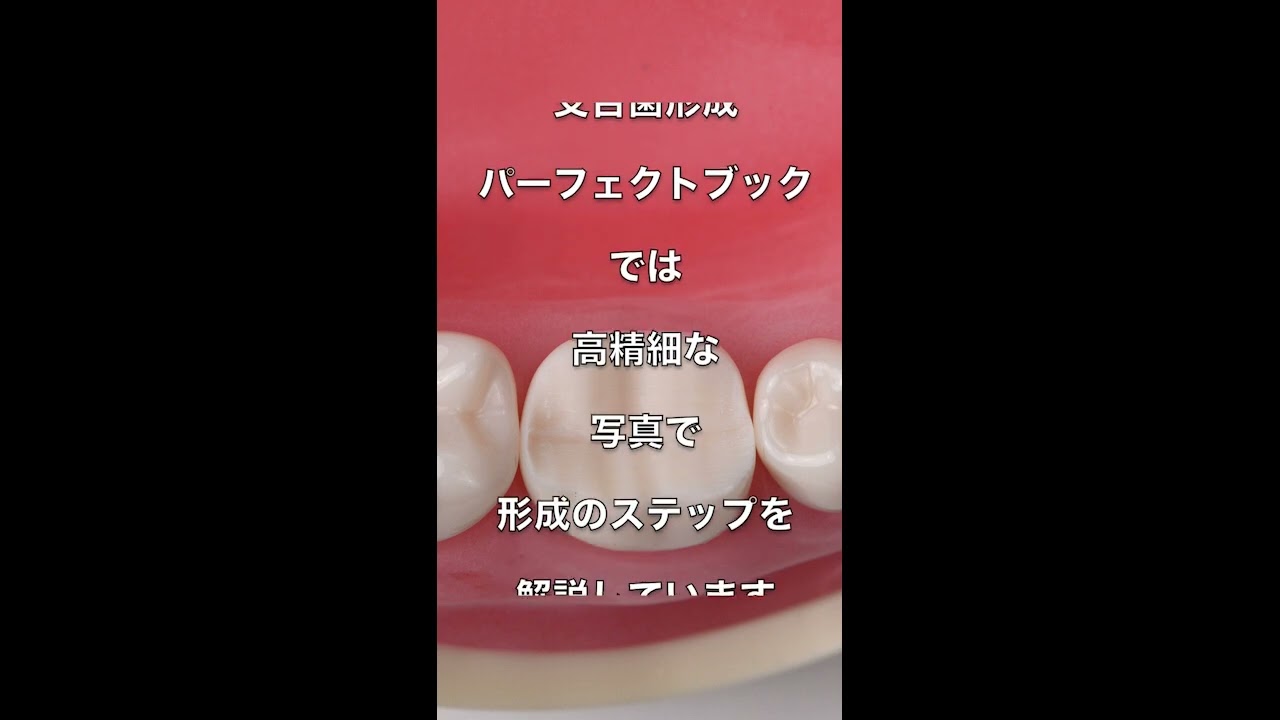 ビジュアルで学ぶ支台歯形成｜右下6ガイドグルーブ【書籍紹介動画 第二