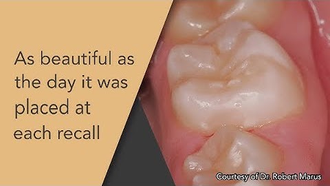 Beauty at Each Recall - G-ænial Universal Inectable