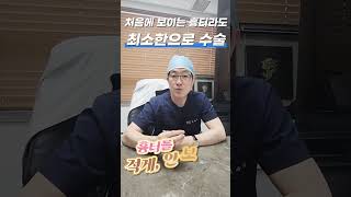 하안검 수술흉터! 심하지않을까요?