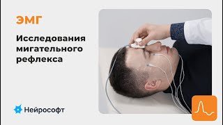 ЭМГ: методика исследования мигательного рефлекса