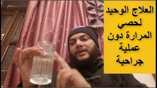 علاج حصى المرارة : وتفتيها واخراجها دون عملية جراحية باشكل طبيعي مع شرح اعراض المرارة screenshot 4