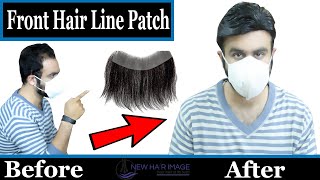 Front Lace Hair Patch Latest Price Front Lace Hair Patch Manufacturer in  DelhiIndia