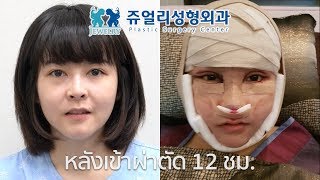 EP3. สรุปศัลยกรรมเกาหลี รีวิวละเอียด! บอกหมดทุกอย่าง I Adearabitty Blog