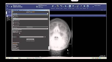 peerVue QICS for Rad-ED Communication (McKesson)