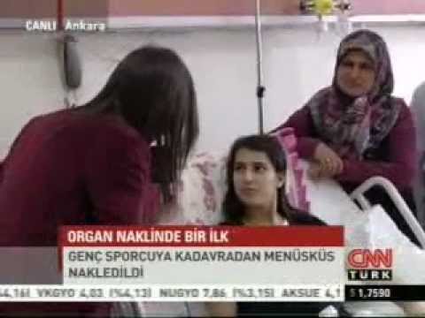 Kadavradan Menisküs Nakli Dünyada İlk | CNN Canlı Bağlantı