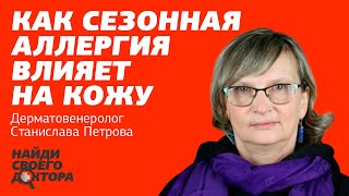 Сезонная аллергия и ее влияние на кожу: Станислава Петрова, к.м.н., дерматовенеролог