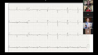 ECG Enthusiasts: Session 1