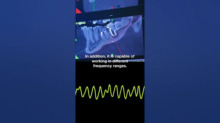 hyperspectral imaging technology