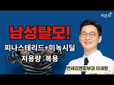 피나스테리드+<strong>미녹시딜</strong> 저용량 복용하면 이렇게 됩니다 / 연세리앤피부과 이세원