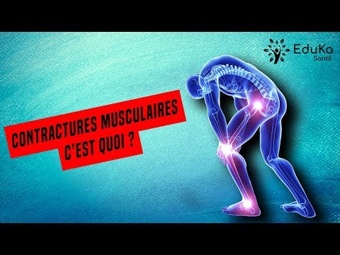 Vidéo: Mes contractions musculaires vont-elles disparaître ?