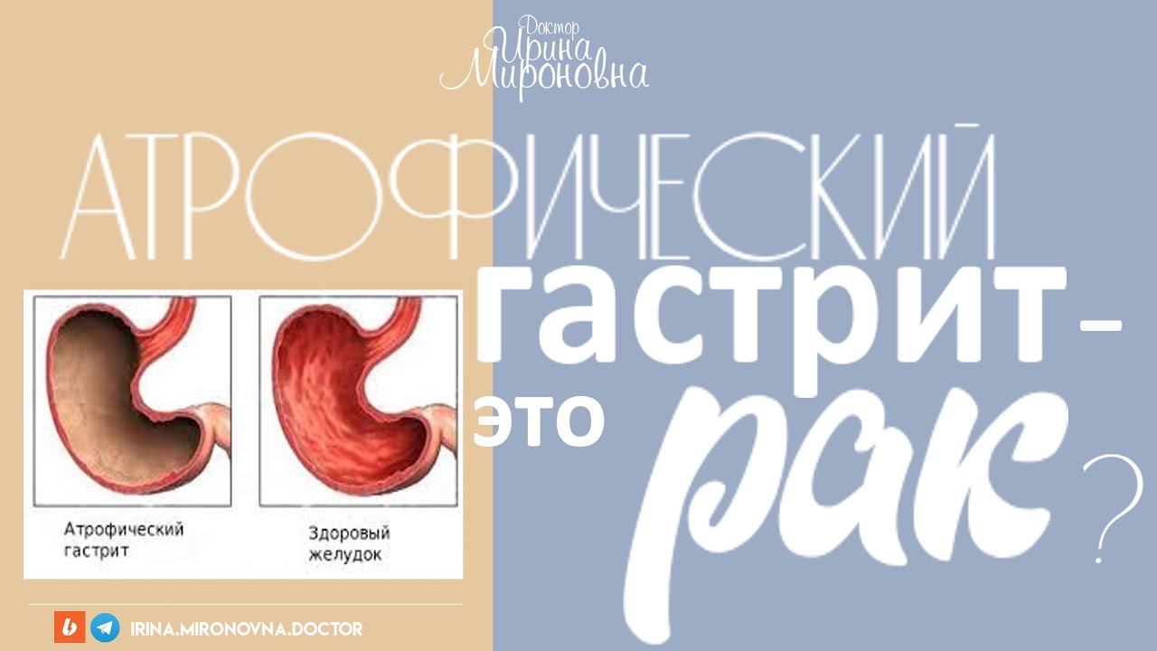 Атрофический гастрит- это рак?