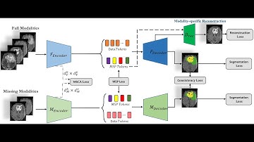 [P115] MMCFormer: Missing Modality Compensation Transformer for Brain Tumor Segmentation